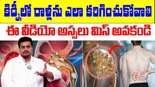 కిడ్నీలో రాళ్లను ఎలా కరిగించుకోవాలి  Kidney Stones Causes Symptomskidneyhealth Kidney Stones [upl. by Simmons]