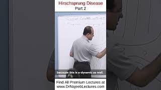 Hirschsprung Disease Part 2 drnajeeb shortvideo youtubeshorts [upl. by Cirek375]