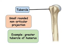 Tubercle Bone Marking [upl. by Gaynor]