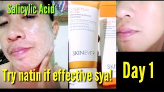 Day 1 Salicylic Acid effective ba [upl. by Queen]