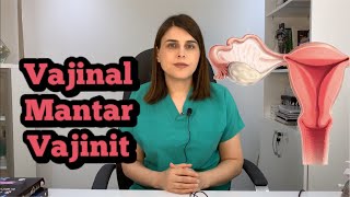 ❓ Vajinal Mantar Belirtileri Nelerdir  Op Dr Funda Yazıcı Erol [upl. by Elene]