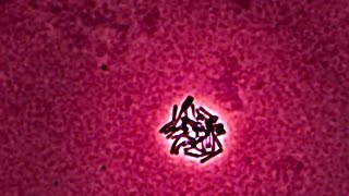 Lactobacillus  Time Lapse Photography [upl. by Atteinotna]