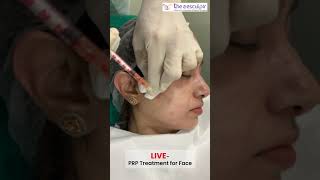 PRP Treatment For Face  shorts [upl. by Nylarej]