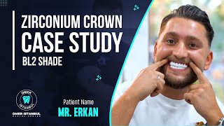 Zirconia Crown Case Study BL2 Shade  Narrated by Dr Omer Karaaslan [upl. by Merilyn]