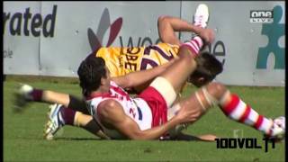 Jaymie Graham Former West Coast Player WORST leg break youll EVER SEE [upl. by Deragon959]