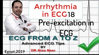 ECG from A to Z intermediate level Arrhythmia 18 Dr Alaa Nasr 2019 [upl. by Anivek]