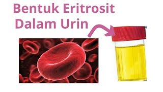 Sedimen urin eritrosit sel darah merah di mikroskop [upl. by Aniaj]