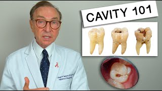 What Causes Tooth Decay Cavity 101  Causes  Treatment [upl. by Littman]