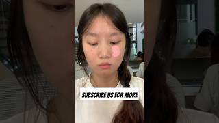 Hiding Face Discoloration Quick Tips for blemished skin  Skincare Beautytips Shorts [upl. by Adriena996]