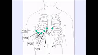 How To Complete Right Side ECG [upl. by Aley]