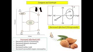 12DaysinMarch Valvular Heart Disease 7 Aortic Stenosis for the USMLE Step One Exam [upl. by Nacnud]