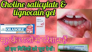 Mouth Ulcer gel choline sacilylate amp lignocain hcl gel use dosage precaution in hindi [upl. by Rossen]