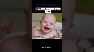 டவுன் syndrome கண்டறிய NIPT உதவுமா trisomy tamil [upl. by Brigitte]