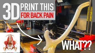 How 3D Printing removed my back pain [upl. by Artur]