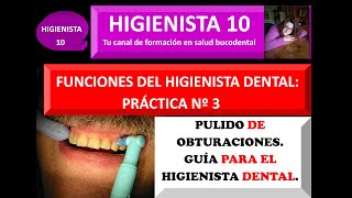 PULIDO DE OBTURACIONES GUÍA PARA EL HIGIENISTA DENTAL [upl. by Rogerg998]