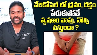 వృషణం వాపు నొప్పి వస్తుందా అయితే ఇలా చేయండి  Causes For Varicocele and Hydrocele Pain  Andro9 [upl. by Esilegna]