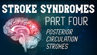 Stroke Syndromes Part 4 of 4  Posterior Circulation Strokes [upl. by Nottap]