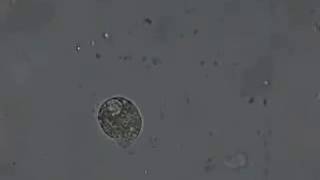 Bacteria Killed By Colloidal Silver [upl. by Ignacius910]