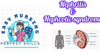 Nephritis amp Nephrotic syndrome 4th sem [upl. by Nicholle51]