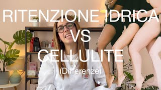 Ep5 Ritenzione idrica VS Cellulite differenze [upl. by Lister205]