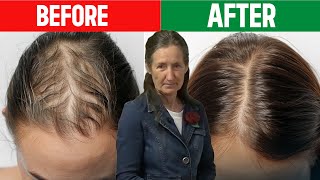 STOP Hair Loss NOW Barbara ONeills SHOCKING Hair Growth Secrets [upl. by Johnsten2]