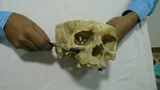 Base of the Skull Anatomical position demonstrated by Dr Zobayer Mahmud Khan [upl. by Aneert]