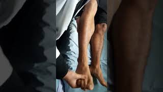 Ankle clonus demonstration [upl. by Seessel]