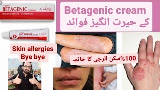 Betagenic cream uses in Urdu [upl. by Aidne]