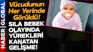 Sıla Bebek Olayında Kan Donduran Gelişme Vücudunun Her Yerinde Görüldü [upl. by Couchman976]