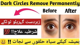 Remove Dark Circles Permanently  How To Get A Rid Of Dark Circles At Home 💯 Results In Few Days [upl. by Landri]