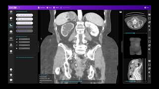 How to measure medical images in 2D [upl. by Nanahs]