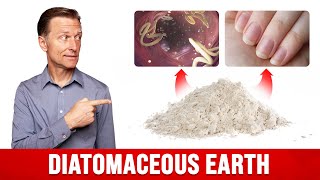 The Benefits of Diatomaceous Earth for Humans [upl. by Fellows210]