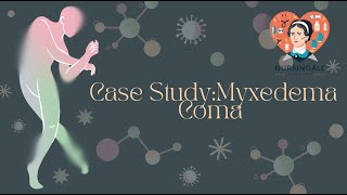 Nursing Management of Myxedema Coma  Medical and Surgical Nursing [upl. by Sairahcaz788]