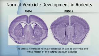 Developmental Neurotoxicity of Ultrafine Particles Parallels with Neurodevelopmental Disorders [upl. by Lange]