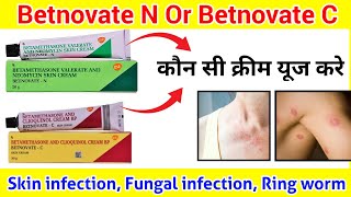 Skin Cream ll Difference between Betnovate N and Betnovate C cream ll How to use Betnovate N ll [upl. by Solomon96]