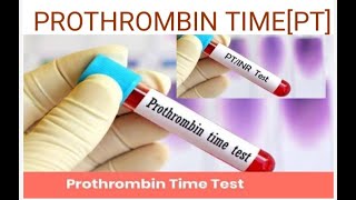 PROTHROMBIN TIME TEST [upl. by Galateah67]