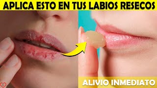 8 Maneras de COMBATIR los LABIOS RESECOS o agrietados NATURALMENTE [upl. by Michiko]