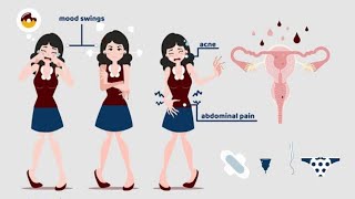 what is Premenstrual Syndrome sign and Symptoms and Treatment in urdi hindi pms [upl. by Tess]