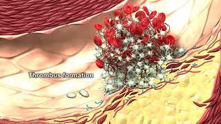 The Role of Autophagy in Thrombus Formation [upl. by Giannini844]