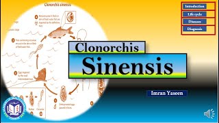 Clonorchis sinensis causes hyperplasia amp fibrosis of biliary tract  Parasitology  by Imran Yaseen [upl. by Sholley]