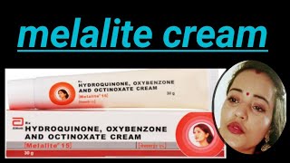 melalite  melalite cream  melalite side effects  melalite review  melasma  black spots cream [upl. by Ahsinod853]