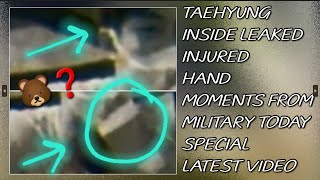 OMG😱💋Taehyung Inside Leaked Injured Hand Moments From Military TodayLatestbtstaehyungjungkook [upl. by Berkly]