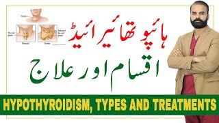 Hypothyroidism  Types and Treatments in UrduHindi [upl. by Aninep198]