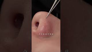 she came to quotcomfortquot her skin immersiveskincare blackheads asmr skinmanagement facialspa [upl. by Arodoet]