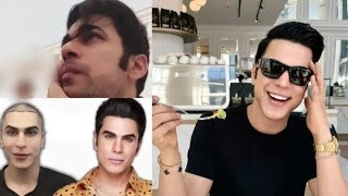 Ken Doll Before And After Surgery Pictures Got Criticism  Ken Doll Surgery  Pakistani Celebrities [upl. by Leuams246]