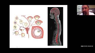 Session 21 on Cerebrospinal Fluid CSF Awakening Awareness with Mauro Zappaterra MD PhD [upl. by Selwyn]