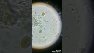 Giardia lamblia cyst [upl. by Lombard65]