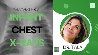 ABCDEs of reading neonatal Chest XRays [upl. by Rexford]