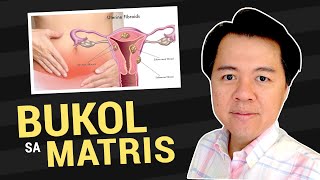 BUKOL sa MATRIS Sintomas at Gamutan  Payo ni Dra Sharon Mendoza OBGyne 1b [upl. by Newkirk]