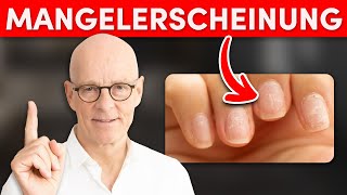 Das sagen Fingernägel über deine Gesundheit aus erstaunlich [upl. by Goodkin83]